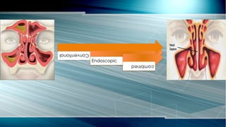 Conventional
Endoscopic
combined
 