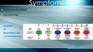  Nasal obstruction: at the same side or on the opposite side.
 Headache: due to contact with lateral wall (Sluder’s neuralgia),
sinusitis.
 Resistant.
 CT
 Nasal Endoscopy.
 +ve Lidocaine test.
Symptoms
 