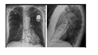 device adalah peralatan yang digunakan.pptx
