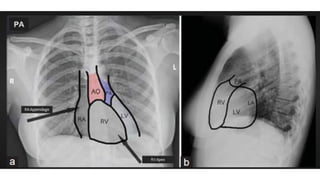 device adalah peralatan yang digunakan.pptx