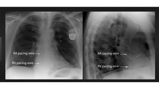 device adalah peralatan yang digunakan.pptx