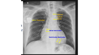 device adalah peralatan yang digunakan.pptx