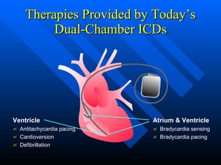 Therapies Provided by Today’s Dual-Chamber ICDs Atrium & Ventricle Ventricle Antitachycardia pacing Cardioversion Defibrillation Bradycardia sensing  Bradycardia pacing 