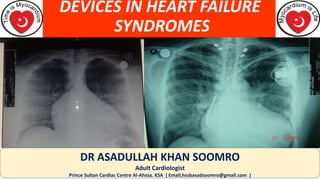 DEVICES IN HEART FAILURE
SYNDROMES
DR ASADULLAH KHAN SOOMRO
Adult Cardiologist
Prince Sultan Cardiac Centre Al-Ahssa. KSA ( Email,hssbasadsoomro@gmail.com )
 