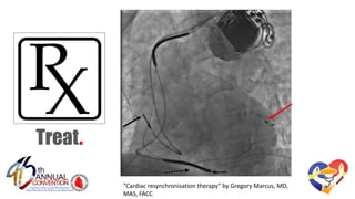 Treat.
"Cardiac resynchronisation therapy" by Gregory Marcus, MD,
MAS, FACC
 