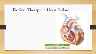 Device Therapy in Heart Failure
Presenter: Dr R P Singh
Moderator: Dr Sameer Mehrotra
 