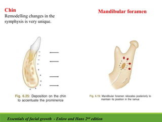 Mandibular foramen
Chin
Remodelling changes in the
symphysis is very unique.
Essentials of facial growth - Enlow and Hans 2nd edition
 