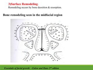 3)Surface Remodeling:
Remodeling occurs by bone deosition & resorption.
Bone remodeling seen in the midfacial region
Essentials of facial growth - Enlow and Hans 2nd edition
 