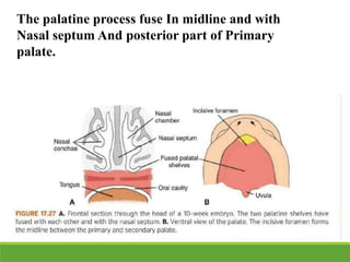 The palatine process fuse In midline and with
Nasal septum And posterior part of Primary
palate.
 