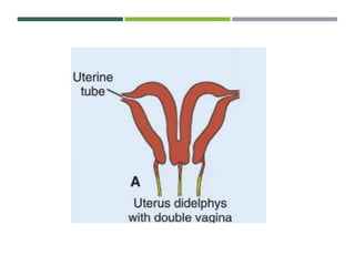 Development of the female reproductive system | PPTX