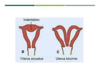 Development of the female reproductive system | PPTX