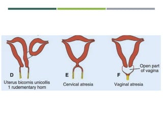 Development of the female reproductive system | PPTX