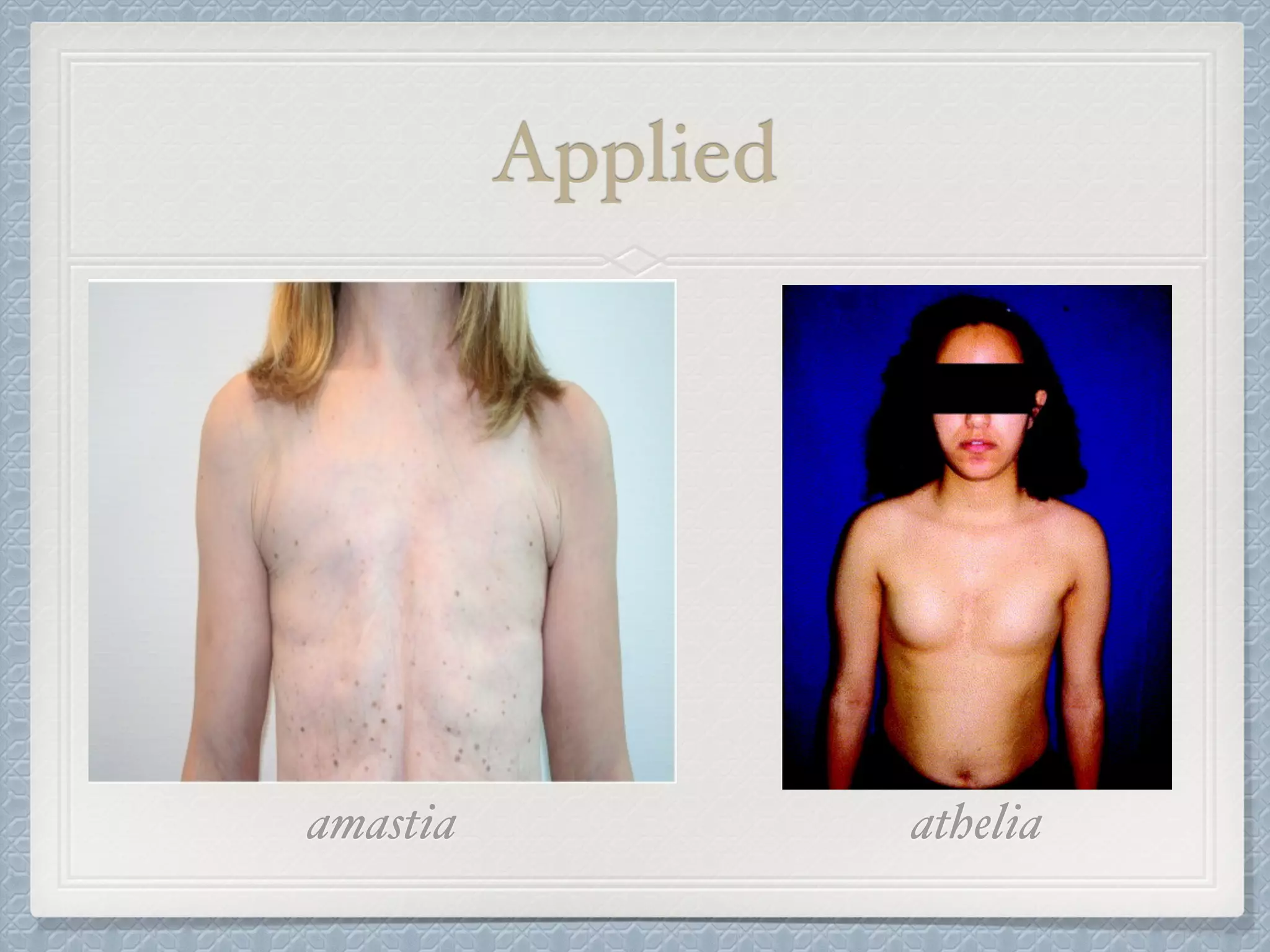 Applied
amastia athelia
 