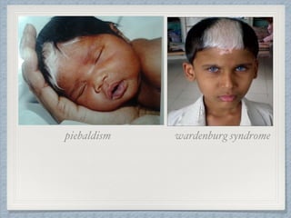 wardenburg syndromepiebaldism
 