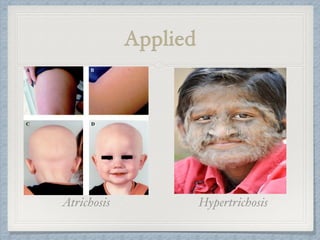 Applied
HypertrichosisAtrichosis
 