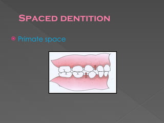 Comprehensive Overview of Primary Dentition and Occlusion in Pediatric ...