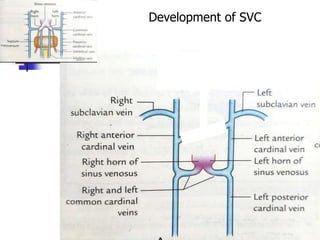 Development of SVC
 