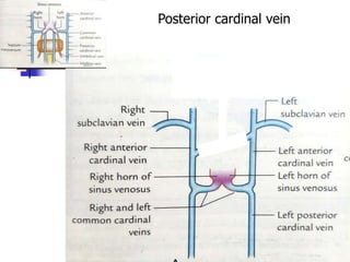 Posterior cardinal vein
 
