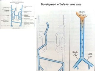 Development of Inferior vena cava
 