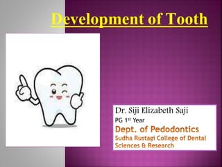Development of Tooth
Dr. Siji Elizabeth Saji
PG 1st Year
 