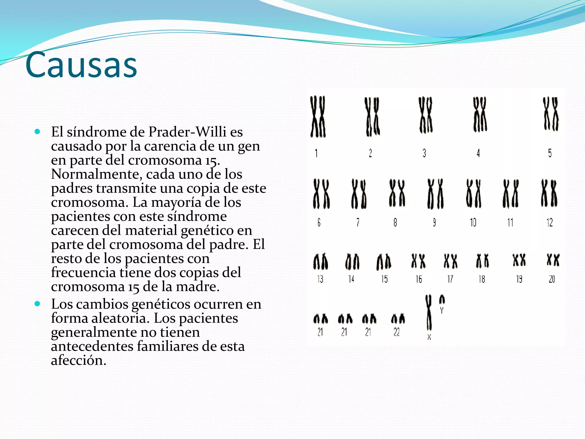 Causas
 El síndrome de Prader-Willi es
causado por la carencia de un gen
en parte del cromosoma 15.
Normalmente, cada uno de los
padres transmite una copia de este
cromosoma. La mayoría de los
pacientes con este síndrome
carecen del material genético en
parte del cromosoma del padre. El
resto de los pacientes con
frecuencia tiene dos copias del
cromosoma 15 de la madre.
 Los cambios genéticos ocurren en
forma aleatoria. Los pacientes
generalmente no tienen
antecedentes familiares de esta
afección.
 