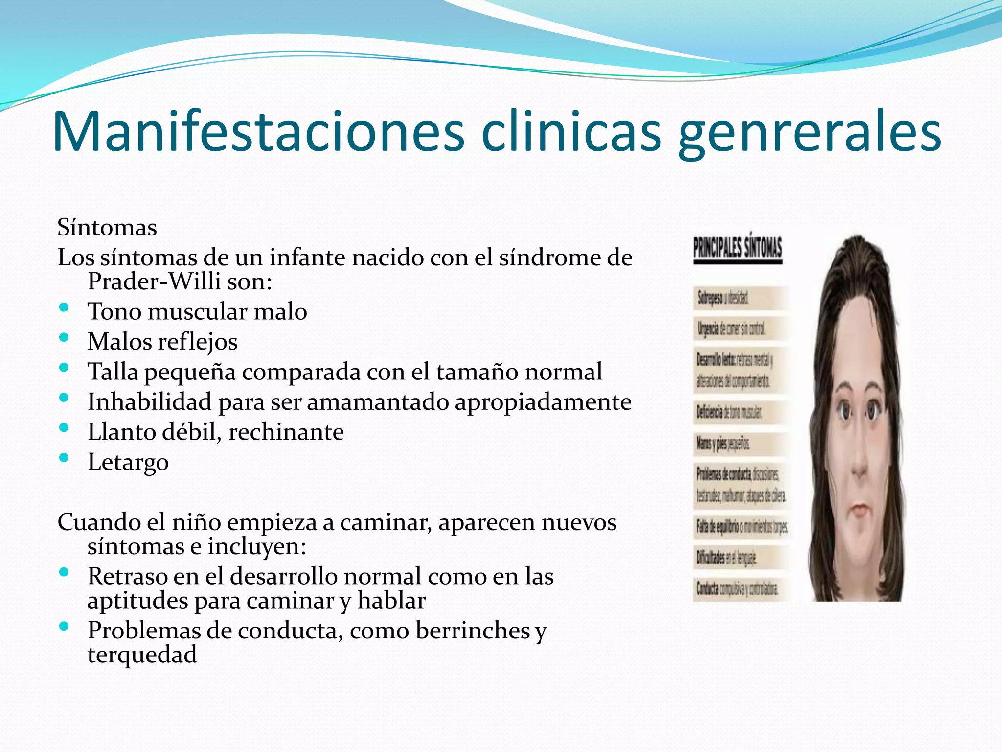Manifestaciones clinicas genrerales
Síntomas
Los síntomas de un infante nacido con el síndrome de
Prader-Willi son:
 Tono muscular malo
 Malos reflejos
 Talla pequeña comparada con el tamaño normal
 Inhabilidad para ser amamantado apropiadamente
 Llanto débil, rechinante
 Letargo
Cuando el niño empieza a caminar, aparecen nuevos
síntomas e incluyen:
 Retraso en el desarrollo normal como en las
aptitudes para caminar y hablar
 Problemas de conducta, como berrinches y
terquedad
 