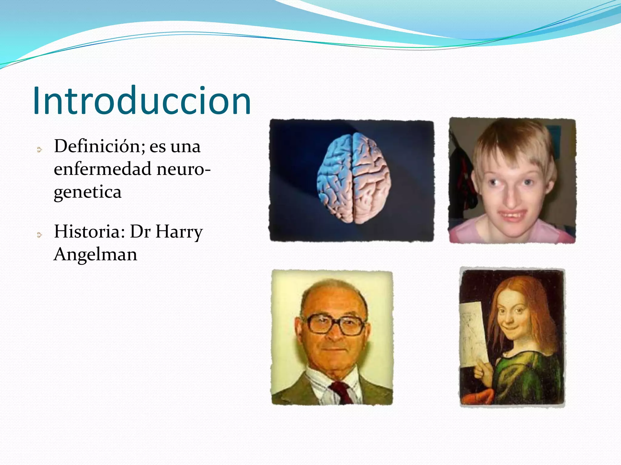 Introduccion
Definición; es una
enfermedad neuro-
genetica
Historia: Dr Harry
Angelman
 