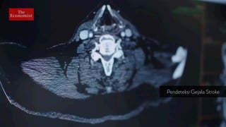 Pendeteksi Gejala Stroke
 