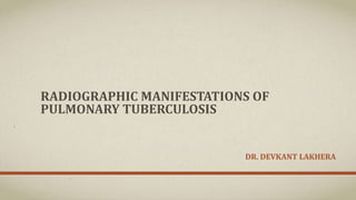 RADIOGRAPHIC MANIFESTATIONS OF
PULMONARY TUBERCULOSIS
DR. DEVKANT LAKHERA
 