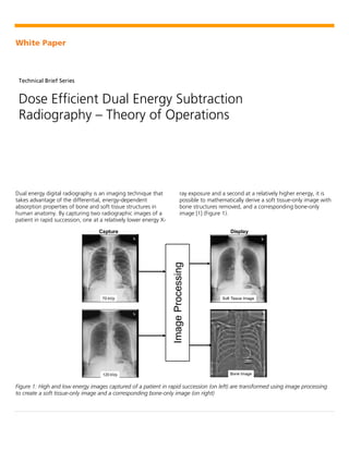 White Paper
Technical Brief Series
Dose Efficient Dual Energy Subtraction
Radiography – Theory of Operations
Dual energy digital radiography is an imaging technique that
takes advantage of the differential, energy-dependent
absorption properties of bone and soft tissue structures in
human anatomy. By capturing two radiographic images of a
patient in rapid succession, one at a relatively lower energy X-
ray exposure and a second at a relatively higher energy, it is
possible to mathematically derive a soft tissue-only image with
bone structures removed, and a corresponding bone-only
image [1] (Figure 1).
Figure 1: High and low energy images captured of a patient in rapid succession (on left) are transformed using image processing
to create a soft tissue-only image and a corresponding bone-only image (on right)
120 kVp
70 kVp
Capture
Bone Image
Soft Tissue Image
Display
Image
Processing
 