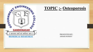 TOPIC :- Osteoporosis
BIOMEDICAL DEPARTMENT
PRESENTED BY;
AMAR PANDEY
 