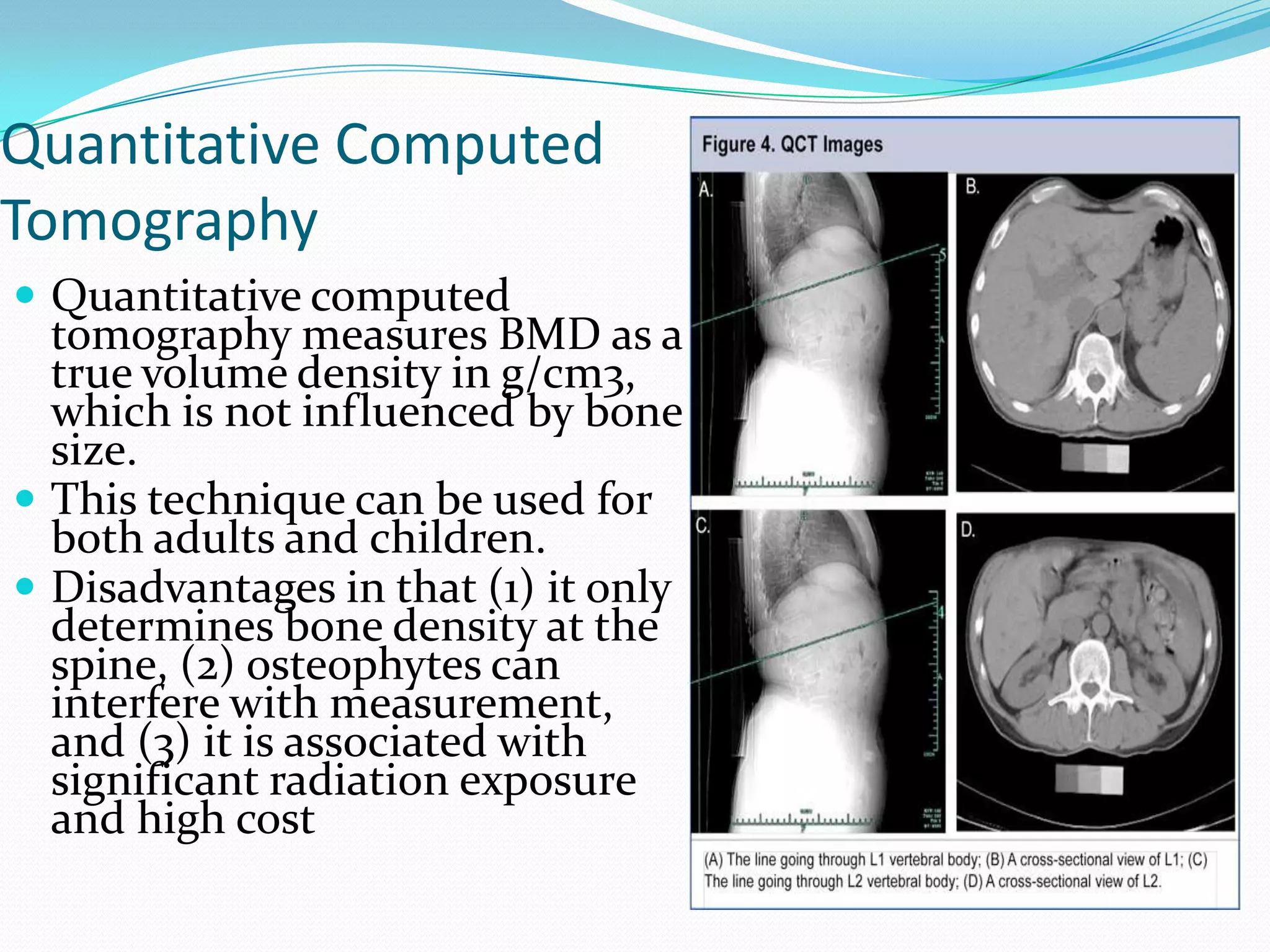 Quantitative Computed
Tomography
 Quantitative computed

tomography measures BMD as a
true volume density in g/cm3,
which is not influenced by bone
size.
 This technique can be used for
both adults and children.
 Disadvantages in that (1) it only
determines bone density at the
spine, (2) osteophytes can
interfere with measurement,
and (3) it is associated with
significant radiation exposure
and high cost

 