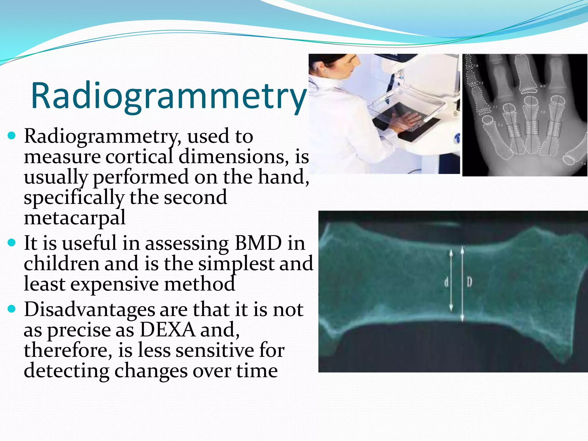 Radiogrammetry
 Radiogrammetry, used to

measure cortical dimensions, is
usually performed on the hand,
specifically the second
metacarpal
 It is useful in assessing BMD in
children and is the simplest and
least expensive method
 Disadvantages are that it is not
as precise as DEXA and,
therefore, is less sensitive for
detecting changes over time

 