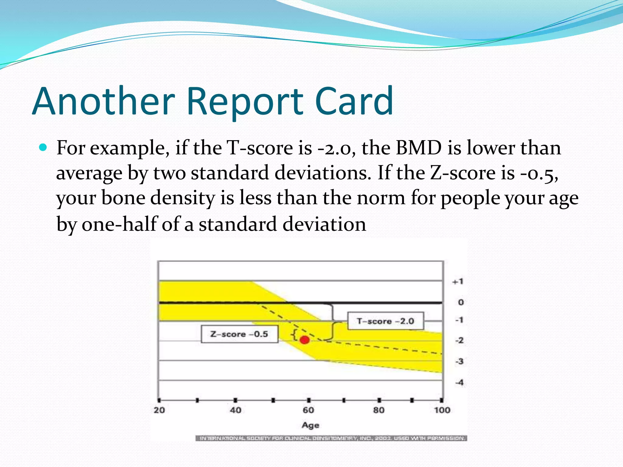 Another Report Card
 For example, if the T-score is -2.0, the BMD is lower than

average by two standard deviations. If the Z-score is -0.5,
your bone density is less than the norm for people your age
by one-half of a standard deviation

 