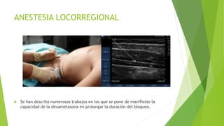 ANESTESIA LOCORREGIONAL
 Se han descrito numerosos trabajos en los que se pone de manifiesto la
capacidad de la dexametasona en prolongar la duración del bloqueo.
 