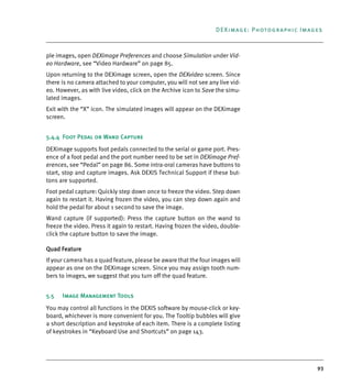 93
DEXimage: Photographic Images
ple images, open DEXimage Preferences and choose Simulation under Vid-
eo Hardware, see “Video Hardware” on page 85.
Upon returning to the DEXimage screen, open the DEXvideo screen. Since
there is no camera attached to your computer, you will not see any live vid-
eo. However, as with live video, click on the Archive icon to Save the simu-
lated images.
Exit with the “X” icon. The simulated images will appear on the DEXimage
screen.
5.4.4 Foot Pedal or Wand Capture
DEXimage supports foot pedals connected to the serial or game port. Pres-
ence of a foot pedal and the port number need to be set in DEXimage Pref-
erences, see “Pedal” on page 86. Some intra-oral cameras have buttons to
start, stop and capture images. Ask DEXIS Technical Support if these but-
tons are supported.
Foot pedal capture: Quickly step down once to freeze the video. Step down
again to restart it. Having frozen the video, you can step down again and
hold the pedal for about 1 second to save the image.
Wand capture (if supported): Press the capture button on the wand to
freeze the video. Press it again to restart. Having frozen the video, double-
click the capture button to save the image.
Quad Feature
If your camera has a quad feature, please be aware that the four images will
appear as one on the DEXimage screen. Since you may assign tooth num-
bers to images, we suggest that you turn off the quad feature.
5.5 Image Management Tools
You may control all functions in the DEXIS software by mouse-click or key-
board, whichever is more convenient for you. The Tooltip bubbles will give
a short description and keystroke of each item. There is a complete listing
of keystrokes in “Keyboard Use and Shortcuts” on page 143.
DEXIS_9_EN.book Page 93 Tuesday, October 5, 2010 12:58 PM
 