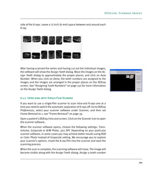 101
DEXscan: Scanned Images
side of the X-rays. Leave a ¼ inch (6 mm) space between and around each
X-ray.
After having scanned the series and having cut out the individual images,
the software will show the Assign Teeth dialog. Move the images on the As-
sign Teeth dialog to approximately the proper places, and click on Auto
Number. When you click on Done, the teeth numbers are assigned to the
images and the images are arranged in the proper places on the DEXray
screen. See “Assigning Tooth Numbers” on page 150 for more information
on the Assign Teeth dialog.
6.1.2 Intra-oral with Single-Film Scanner
If you want to use a single-film scanner to scan intra-oral X-rays one at a
time you need to switch the automatic separation of X-rays off. Go to DEXray
Preferences, select your scanner software under Scanner, and then set
Frame Removal to 1, see “Frame Removal” on page 39.
Open a patient’s DEXray intra-oral screen. Click on the Scanner icon to open
the scanner software.
When the scanner software opens, choose the following settings: Trans-
missive, Grayscale or B/W Photo, 300 DPI. Depending on your particular
scanner software, in some cases you may achieve better results using RGB
or Color Photo instead of Grayscale setting. We encourage you to explore
your scanner’s options. Insert the X-ray film into the scanner and start the
scanning process.
When the scan is complete, the scanning software will close. The image will
become visible along with the Assign Teeth dialog. Assign a tooth number
DEXIS_9_EN.book Page 101 Tuesday, October 5, 2010 12:58 PM
 