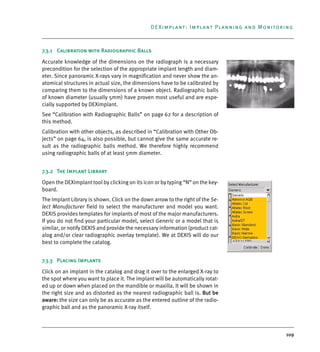 109
DEXimplant: Implant Planning and Monitoring
7.3.1 Calibration with Radiographic Balls
Accurate knowledge of the dimensions on the radiograph is a necessary
precondition for the selection of the appropriate implant length and diam-
eter. Since panoramic X-rays vary in magnification and never show the an-
atomical structures in actual size, the dimensions have to be calibrated by
comparing them to the dimensions of a known object. Radiographic balls
of known diameter (usually 5mm) have proven most useful and are espe-
cially supported by DEXimplant.
See “Calibration with Radiographic Balls” on page 62 for a description of
this method.
Calibration with other objects, as described in “Calibration with Other Ob-
jects” on page 64, is also possible, but cannot give the same accurate re-
sult as the radiographic balls method. We therefore highly recommend
using radiographic balls of at least 5mm diameter.
7.3.2 The Implant Library
Open the DEXimplant tool by clicking on its icon or by typing “N” on the key-
board.
The Implant Library is shown. Click on the down arrow to the right of the Se-
lect Manufacturer field to select the manufacturer and model you want.
DEXIS provides templates for implants of most of the major manufacturers.
If you do not find your particular model, select Generic or a model that is
similar, or notify DEXIS and provide the necessary information (product cat-
alog and/or clear radiographic overlay template). We at DEXIS will do our
best to complete the catalog.
7.3.3 Placing Implants
Click on an implant in the catalog and drag it over to the enlarged X-ray to
the spot where you want to place it. The implant will be automatically rotat-
ed up or down when placed on the mandible or maxilla. It will be shown in
the right size and as distorted as the nearest radiographic ball is. But be
aware: the size can only be as accurate as the entered outline of the radio-
graphic ball and as the panoramic X-ray itself.
DEXIS_9_EN.book Page 109 Tuesday, October 5, 2010 12:58 PM
 