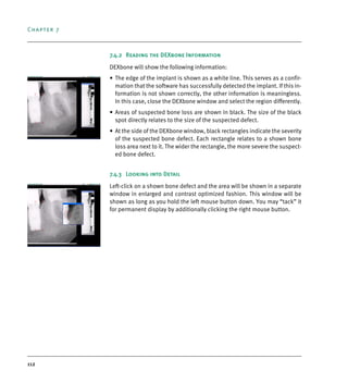 Chapter 7
112
7.4.2 Reading the DEXbone Information
DEXbone will show the following information:
• The edge of the implant is shown as a white line. This serves as a confir-
mation that the software has successfully detected the implant. If this in-
formation is not shown correctly, the other information is meaningless.
In this case, close the DEXbone window and select the region differently.
• Areas of suspected bone loss are shown in black. The size of the black
spot directly relates to the size of the suspected defect.
• At the side of the DEXbone window, black rectangles indicate the severity
of the suspected bone defect. Each rectangle relates to a shown bone
loss area next to it. The wider the rectangle, the more severe the suspect-
ed bone defect.
7.4.3 Looking into Detail
Left-click on a shown bone defect and the area will be shown in a separate
window in enlarged and contrast optimized fashion. This window will be
shown as long as you hold the left mouse button down. You may “tack” it
for permanent display by additionally clicking the right mouse button.
DEXIS_9_EN.book Page 112 Tuesday, October 5, 2010 12:58 PM
 