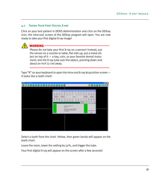 37
DEXray: X-ray Images
4.2 Taking Your First Digital X-ray
Click on your test patient in DEXIS Administration and click on the DEXray
icon: the intra-oral screen of the DEXray program will open. You are now
ready to take your first digital X-ray image!
WARNING
Please do not take your first X-ray on a person! Instead, put
the sensor on a counter or table, flat side up; put a metal ob-
ject on top of it — a key, coin, or your favorite dental instru-
ment; aim the X-ray tube over the object, pointing down and
about an inch (2 cm) away.
Type “X” on your keyboard to open the Intra-oral X-ray Acquisition screen —
it looks like a tooth chart!
Select a tooth from the chart. Yellow, then green bands will appear on the
tooth chart.
Leave the room, lower the setting by 50%, and trigger the tube.
Your first digital X-ray will appear on the screen after a few seconds!
DEXIS_9_EN.book Page 37 Tuesday, October 5, 2010 12:58 PM
 