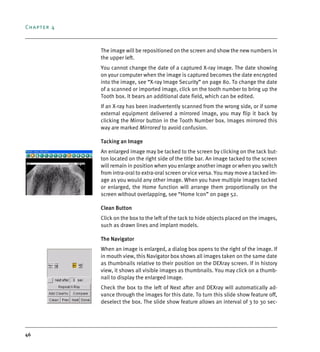 Chapter 4
46
The image will be repositioned on the screen and show the new numbers in
the upper left.
You cannot change the date of a captured X-ray image. The date showing
on your computer when the image is captured becomes the date encrypted
into the image, see “X-ray Image Security” on page 80. To change the date
of a scanned or imported image, click on the tooth number to bring up the
Tooth box. It bears an additional date field, which can be edited.
If an X-ray has been inadvertently scanned from the wrong side, or if some
external equipment delivered a mirrored image, you may flip it back by
clicking the Mirror button in the Tooth Number box. Images mirrored this
way are marked Mirrored to avoid confusion.
Tacking an Image
An enlarged image may be tacked to the screen by clicking on the tack but-
ton located on the right side of the title bar. An image tacked to the screen
will remain in position when you enlarge another image or when you switch
from intra-oral to extra-oral screen or vice versa. You may move a tacked im-
age as you would any other image. When you have multiple images tacked
or enlarged, the Home function will arrange them proportionally on the
screen without overlapping, see “Home Icon” on page 52.
Clean Button
Click on the box to the left of the tack to hide objects placed on the images,
such as drawn lines and implant models.
The Navigator
When an image is enlarged, a dialog box opens to the right of the image. If
in mouth view, this Navigator box shows all images taken on the same date
as thumbnails relative to their position on the DEXray screen. If in history
view, it shows all visible images as thumbnails. You may click on a thumb-
nail to display the enlarged image.
Check the box to the left of Next after and DEXray will automatically ad-
vance through the images for this date. To turn this slide show feature off,
deselect the box. The slide show feature allows an interval of 3 to 30 sec-
DEXIS_9_EN.book Page 46 Tuesday, October 5, 2010 12:58 PM
 