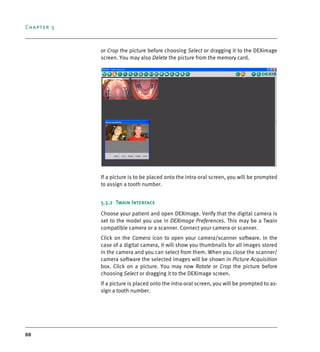 Chapter 5
88
or Crop the picture before choosing Select or dragging it to the DEXimage
screen. You may also Delete the picture from the memory card.
If a picture is to be placed onto the intra-oral screen, you will be prompted
to assign a tooth number.
5.3.2 Twain Interface
Choose your patient and open DEXimage. Verify that the digital camera is
set to the model you use in DEXimage Preferences. This may be a Twain
compatible camera or a scanner. Connect your camera or scanner.
Click on the Camera icon to open your camera/scanner software. In the
case of a digital camera, it will show you thumbnails for all images stored
in the camera and you can select from them. When you close the scanner/
camera software the selected images will be shown in Picture Acquisition
box. Click on a picture. You may now Rotate or Crop the picture before
choosing Select or dragging it to the DEXimage screen.
If a picture is placed onto the intra-oral screen, you will be prompted to as-
sign a tooth number.
DEXIS_9_EN.book Page 88 Tuesday, October 5, 2010 12:58 PM
 