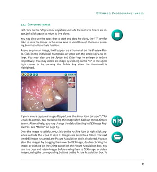 91
DEXimage: Photographic Images
5.4.2 Capturing Images
Left-click on the Stop icon or anywhere outside the icons to freeze an im-
age. Left-click again to return to live video.
You may also use the space bar to start and stop the video, the “T” key (for
take) to save the image, or the arrow keys to scroll through the icons, press-
ing Enter to initiate their function.
As you acquire an image, it will appear as a thumbnail on the Preview Pan-
el. Click on the individual thumbnail, or scroll with the arrow keys, to en-
large. You may also use the Space and Enter keys to enlarge or reduce
respectively. You may delete an image by clicking on the “x” in the upper
right corner or by pressing the Delete key when the thumbnail is
highlighted.
If your camera captures images flipped, use the Mirror icon (or type “U” for
U-turn) to correct. You may also flip the image when back on the DEXimage
screen. Alternatively, you may change the default setting in DEXimage Pref-
erences, see “Mirror” on page 85.
Once the image is satisfactory, click on the Archive icon or right-click any-
where outside the icons to save it. Images are saved to a folder. The next
time DEXimage is started, the Picture Acquisition box is displayed. You can
store the images by dragging them over to DEXimage, double-clicking the
image, or clicking on the Select button on the Picture Acquisition box. You
can also crop and rotate images before saving them to DEXimage, or delete
images, using the corresponding buttons on the Picture Acquisition box. To
DEXIS_9_EN.book Page 91 Tuesday, October 5, 2010 12:58 PM
 