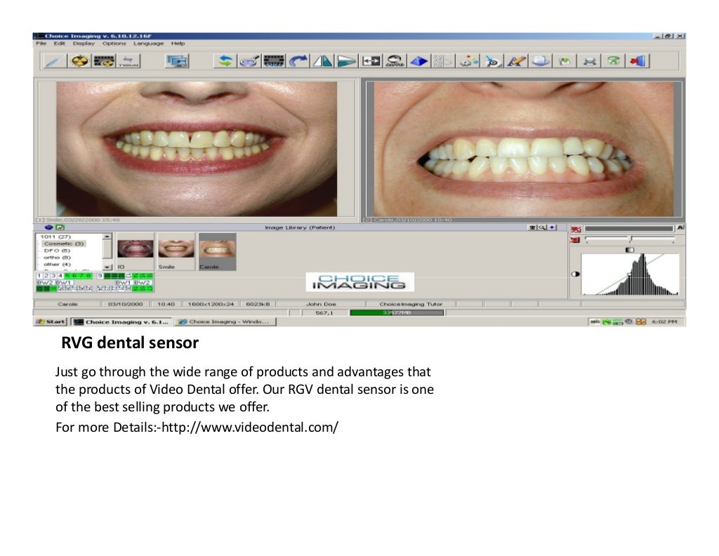 Dexis dental sensor