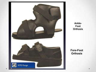 Fore-Foot
Orthosis
Ankle-
Foot
Orthosis
 