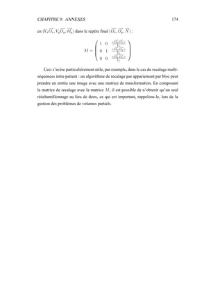 CHAPITRE 9. ANNEXES 174
en (Vx
−→
Ox, Vy
−→
Oy,
−→
δIp) dans le repère ﬁnal (
−→
Ox,
−→
Oy,
−→
N ) :
M =




1 0 <
−→
δIp,
−→
Ox>
Vx
0 1 <
−→
δIp,
−→
Oy>
Vy
0 0 <
−→
δIp,
−→
Oz>
Vz




Ceci s’avère particulièrement utile, par exemple, dans le cas du recalage multi-
séquences intra-patient : un algorithme de recalage par appariement par bloc peut
prendre en entrée une image avec une matrice de transformation. En composant
la matrice de recalage avec la matrice M, il est possible de n’obtenir qu’un seul
rééchantillonnage au lieu de deux, ce qui est important, rappelons-le, lors de la
gestion des problèmes de volumes partiels.
 