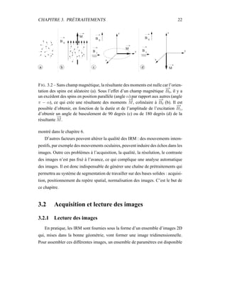 CHAPITRE 3. PRÉTRAITEMENTS 22
a
B 1
M
B 0
c
x
y
z
B 1
M
B 0
d
x
y
z
M
b
B 0
FIG. 3.2 – Sans champ magnétique, la résultante des moments est nulle car l’orien-
tation des spins est aléatoire (a). Sous l’effet d’un champ magnétique
−→
B0, il y a
un excédent des spins en position parallèle (angle α) par rapport aux autres (angle
π − α), ce qui crée une résultante des moments
−→
M, colinéaire à
−→
B0 (b). Il est
possible d’obtenir, en fonction de la durée et de l’amplitude de l’excitation
−→
B1,
d’obtenir un angle de basculement de 90 degrés (c) ou de 180 degrés (d) de la
résultante
−→
M.
montré dans le chapitre 6.
D’autres facteurs peuvent altérer la qualité des IRM : des mouvements intem-
pestifs, par exemple des mouvements oculaires, peuvent induire des échos dans les
images. Outre ces problèmes à l’acquisition, la qualité, la résolution, le contraste
des images n’est pas ﬁxé à l’avance, ce qui complique une analyse automatique
des images. Il est donc indispensable de générer une chaîne de prétraitements qui
permettra au système de segmentation de travailler sur des bases solides : acquisi-
tion, positionnement du repère spatial, normalisation des images. C’est le but de
ce chapitre.
3.2 Acquisition et lecture des images
3.2.1 Lecture des images
En pratique, les IRM sont fournies sous la forme d’un ensemble d’images 2D
qui, mises dans la bonne géométrie, vont former une image tridimensionnelle.
Pour assembler ces différentes images, un ensemble de paramètres est disponible
 