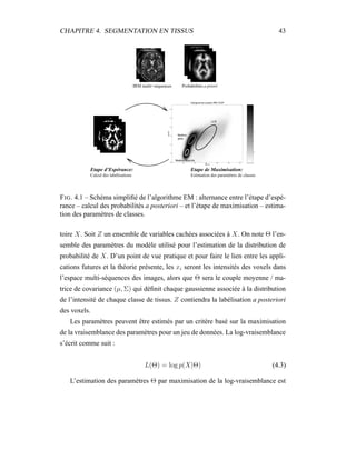 CHAPITRE 4. SEGMENTATION EN TISSUS 43
IRM multi−séquences
Calcul des labélisations
Etape d’Espérance: Etape de Maximisation:
Estimation des paramètres de classes
Probabilités a priori
FIG. 4.1 – Schéma simpliﬁé de l’algorithme EM : alternance entre l’étape d’espé-
rance – calcul des probabilités a posteriori – et l’étape de maximisation – estima-
tion des paramètres de classes.
toire X. Soit Z un ensemble de variables cachées associées à X. On note Θ l’en-
semble des paramètres du modèle utilisé pour l’estimation de la distribution de
probabilité de X. D’un point de vue pratique et pour faire le lien entre les appli-
cations futures et la théorie présente, les xi seront les intensités des voxels dans
l’espace multi-séquences des images, alors que Θ sera le couple moyenne / ma-
trice de covariance (µ, Σ) qui déﬁnit chaque gaussienne associée à la distribution
de l’intensité de chaque classe de tissus. Z contiendra la labélisation a posteriori
des voxels.
Les paramètres peuvent être estimés par un critère basé sur la maximisation
de la vraisemblance des paramètres pour un jeu de données. La log-vraisemblance
s’écrit comme suit :
L(Θ) = log p(X|Θ) (4.3)
L’estimation des paramètres Θ par maximisation de la log-vraisemblance est
 