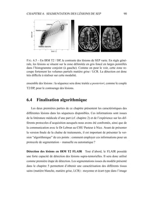 CHAPITRE 6. SEGMENTATION DES LÉSIONS DE SEP 90
0.5
1
1.5
2
2.5
T2 MRI
PDMRI
0 200 400 600 800 1000 1200
600
700
800
900
1000
1100
1200
Matière blanche
Lésions LCR
Matière grise
IRM T2
IRMDP
FIG. 6.5 – En IRM T2 / DP, le contraste des lésions de SEP varie. En règle géné-
rale, les lésions se situent sur la zone délimitée en gris foncé en larges pointillés
dans l’histogramme conjoint (à gauche). Comme on peut le voir, cette zone re-
coupe fortement les volumes partiels matière grise / LCR. La détection est donc
très difﬁcile à réaliser sur cette modalité.
ensemble des lésions : la séquence sera donc traitée a posteriori, comme le couple
T2/DP, pour le contourage des lésions.
6.4 Finalisation algorithmique
Les deux premières parties de ce chapitre présentent les caractéristiques des
différentes lésions dans les séquences disponibles. Ces informations sont issues
de la littérature médicale d’une part (cf. chapitre 2) et de l’expérience sur les dif-
férents protocoles d’acquisition auxquels nous avons été confrontés, ainsi que de
la communication avec le Dr Lebrun au CHU Pasteur à Nice. Avant de présenter
la version ﬁnale de la chaîne de traitements, il est important de présenter la ver-
sion “algorithmique” de ces points : comment employer ces informations pour un
protocole de segmentation – manuelle ou automatique ?
Détection des lésions en IRM T2 FLAIR Tout d’abord, le FLAIR possède
une forte capacité de détection des lésions supra-tentorielles. Il sera donc utilisé
comme première étape de détection. Les segmentations issues du modèle présenté
dans le chapitre 5 permettent d’obtenir une caractérisation des différents tissus
sains (matière blanche, matière grise, LCR) : moyenne et écart type dans l’image
 