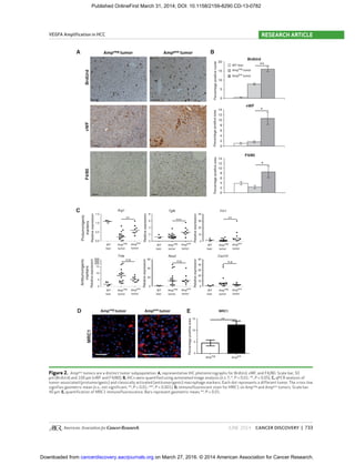 JUNE 2014 CANCER DISCOVERY | 733
VEGFA Ampliﬁcation in HCC RESEARCH ARTICLE
Figure 2. Amppos
tumors are a distinct tumor subpopulation. A, representative IHC photomicrographs for BrdUrd, vWF, and F4/80. Scale bar, 50
μm (BrdUrd) and 100 μm (vWF and F4/80). B, IHCs were quantiﬁed using automated image analysis (n ≥ 7; *, P < 0.01; **, P < 0.05). C, qPCR analysis of
tumor-associated (protumorigenic) and classically activated (antitumorigenic) macrophage markers. Each dot represents a different tumor. The cross line
signiﬁes geometric mean (n.s., not signiﬁcant; **, P < 0.01; ***, P < 0.001). D, immunoﬂuorescent stain for MRC1 on Ampneg
and Amppos
tumors. Scale bar,
40 μm. E, quantiﬁcation of MRC1 immunoﬂuorescence. Bars represent geometric mean; **, P < 0.01.
B
C
n.s.n.s.
n.s.
Antitumorigenic
markers
***** **
Protumorigenic
markers
Ampneg tumor Amppos tumor
Amppos
tumor
Ampneg
tumor
WT liver
Ampneg tumor Amppos tumor
BrdUrd
0
5
10
15
20
vWF
Percentagepositivenuclei
**
BrdUrd
vWF
0
2
4
6
8
10
12
14
Percentagepositivearea
vWF
*
F4/80
0
2
4
6
8
10
12
14
Percentagepositivearea
*
F4/80
A
D
MRC1
E MRC1
**
1.5
Arg1
Nos2 Cxcl10
Tgfb Ym1
Tnfa
8 40
30
20
10
0
6
4
2
0
1.0
0.5
RelativeexpressionRelativeexpression
Relativeexpression
Relativeexpression
Percentagepositivearea
Relativeexpression
Relativeexpression
0.0
600 50
40
30
20
10
0
15
10
5
0
60
40
20
0
400
200
15
10
5
0
WT
liver
Amp
neg
tumor
Amp
pos
tumor
WT
liver
Amp
neg
tumor
Amppos
tumor
WT
liver
Ampneg
tumor
Amppos
tumor
WT
liver
Amp
neg
tumor
Amp
pos
tumor
WT
liver
Amp
neg
tumor
Amp
pos
tumor
Amp
neg
Amp
pos
WT
liver
Amp
neg
tumor
Amp
pos
tumor
on March 27, 2016. © 2014 American Association for Cancer Research.cancerdiscovery.aacrjournals.orgDownloaded from
Published OnlineFirst March 31, 2014; DOI: 10.1158/2159-8290.CD-13-0782
 